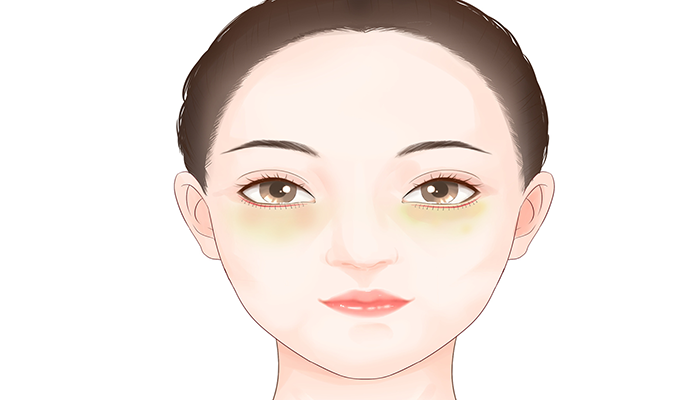 激光去眼袋效果如何