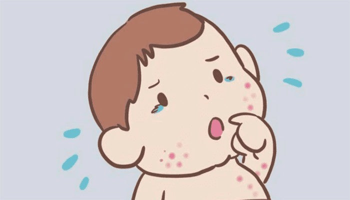 儿童春天易过敏怎么办？怎么护理？