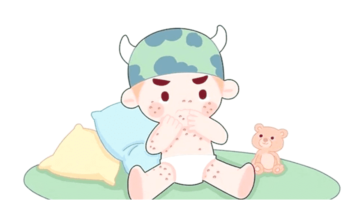 儿童夏天易长痱子怎么办？怎么护理？